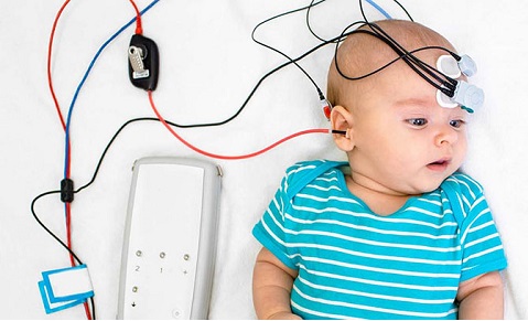 غربالگری شنوایی بدو تولد، در تشخیص زودهنگام کاهش شنوایی اهمیت بالایی دارد